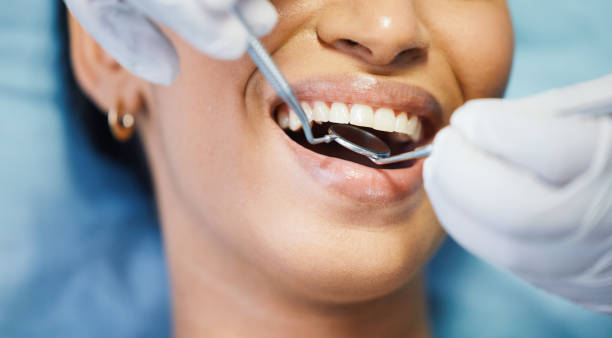 Best Emergency Dentist for Knocked-Out Tooth in Nescopeck, PA