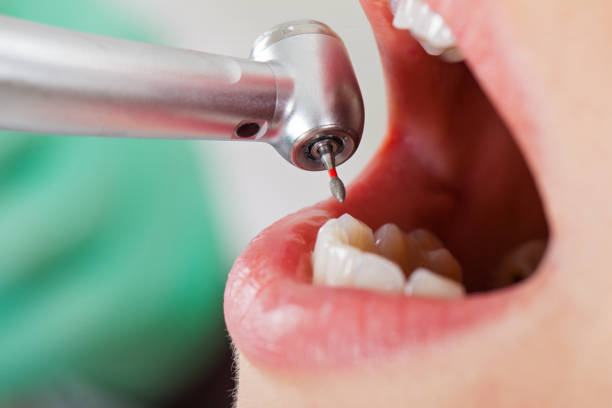 Best Pediatric Emergency Dentist in Nescopeck, PA